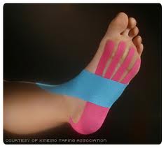 Kinesio-tape-plantar-fascia.jpg