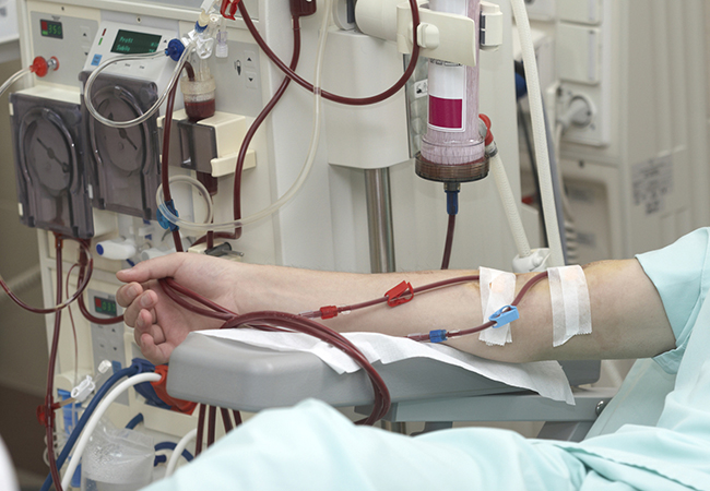resultados-cirugia-columna-pacientes-con-hemodialisis-GDjpg