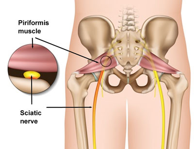 piriformis-detail400.jpg