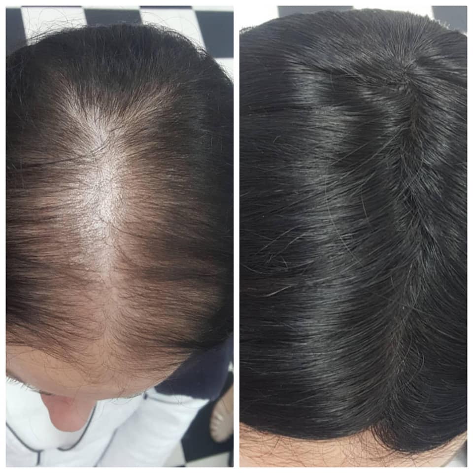 t parting hair pieces