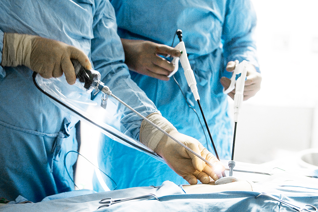 Laparoscopic-Surgeryjpg