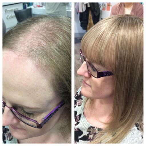 t parting hair pieces