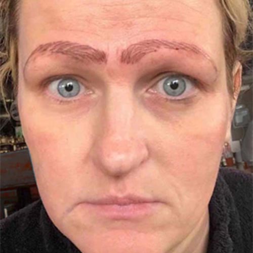 Woman Bad Microblading Microbladed Eyebrows Worst Case Story Nightmare Horrid Eyebrows