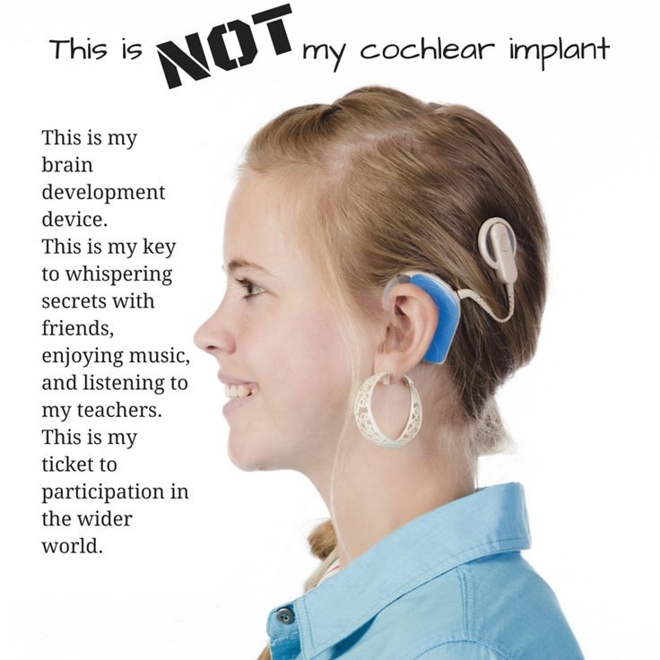 Cochlear Implant Campaign Results