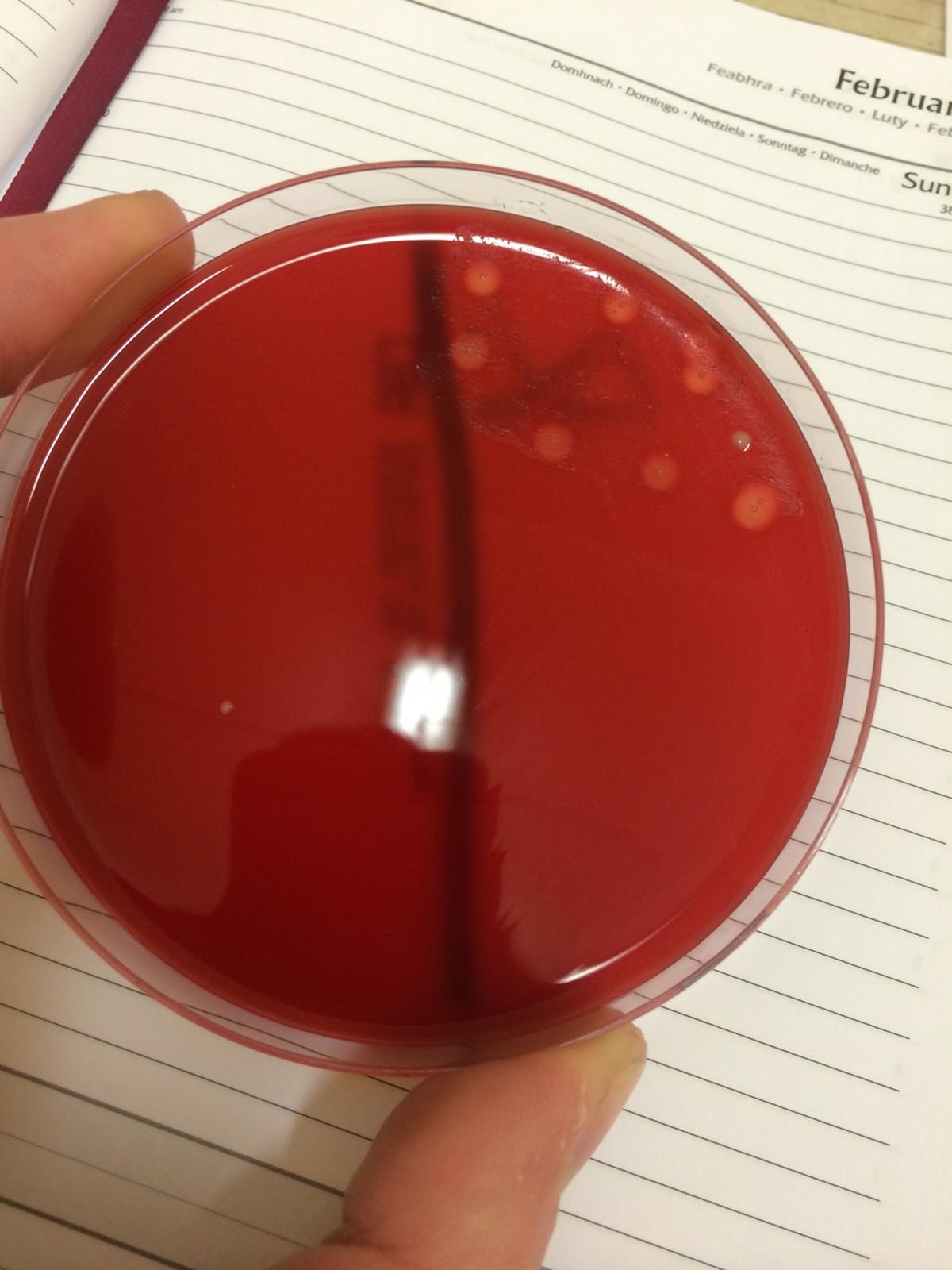 Microbiology- bacterial culture