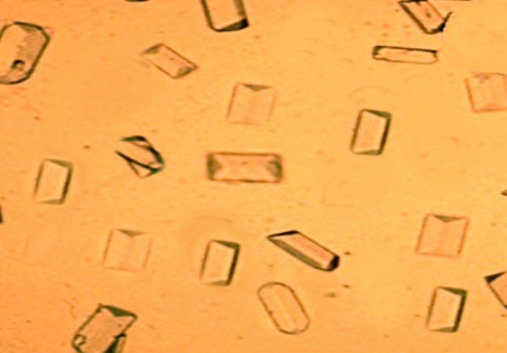 calcium oxalate crystals