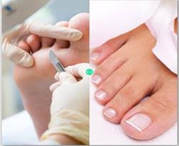medisch pedicure