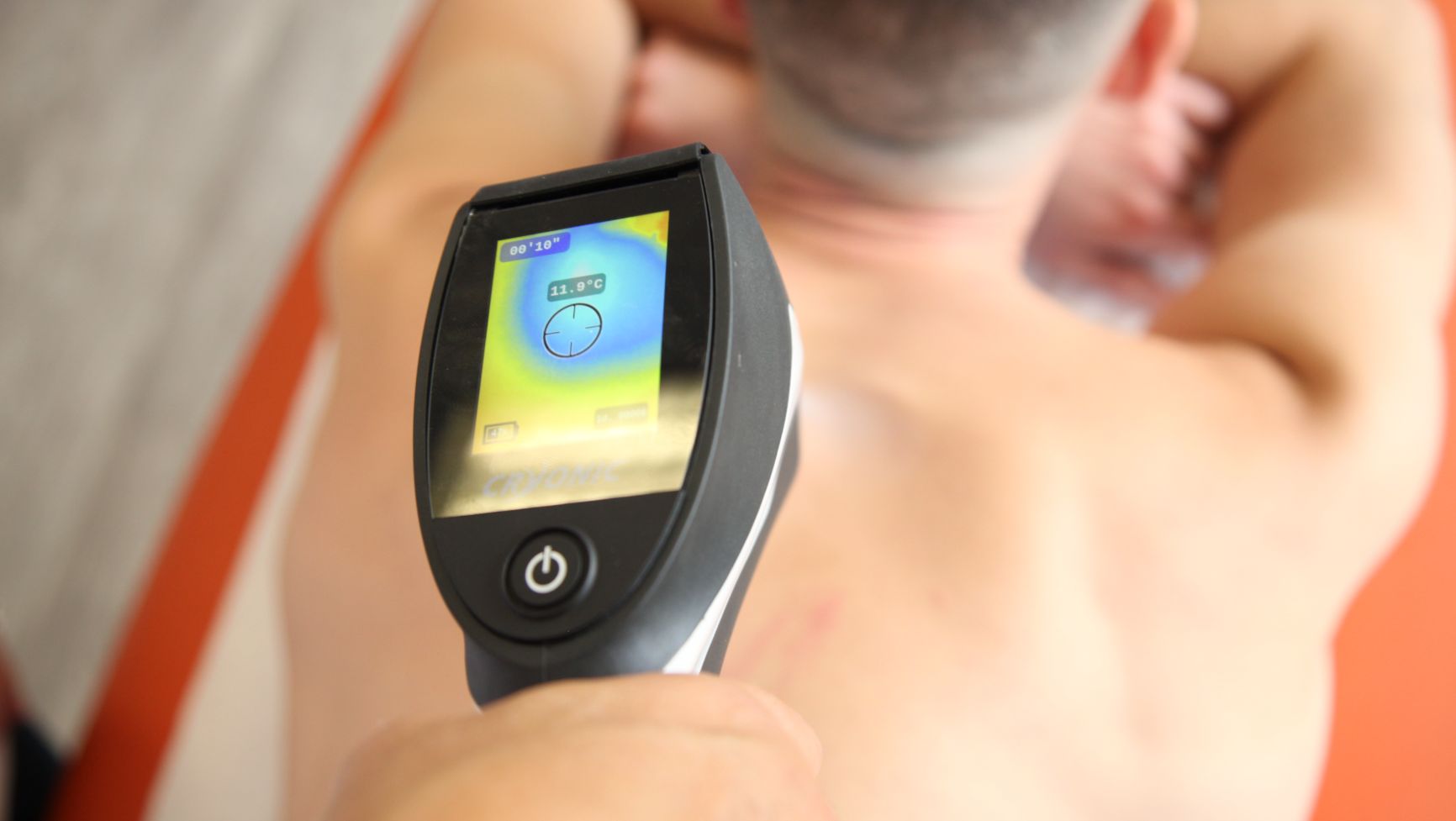 Cryotherapie bij mensen