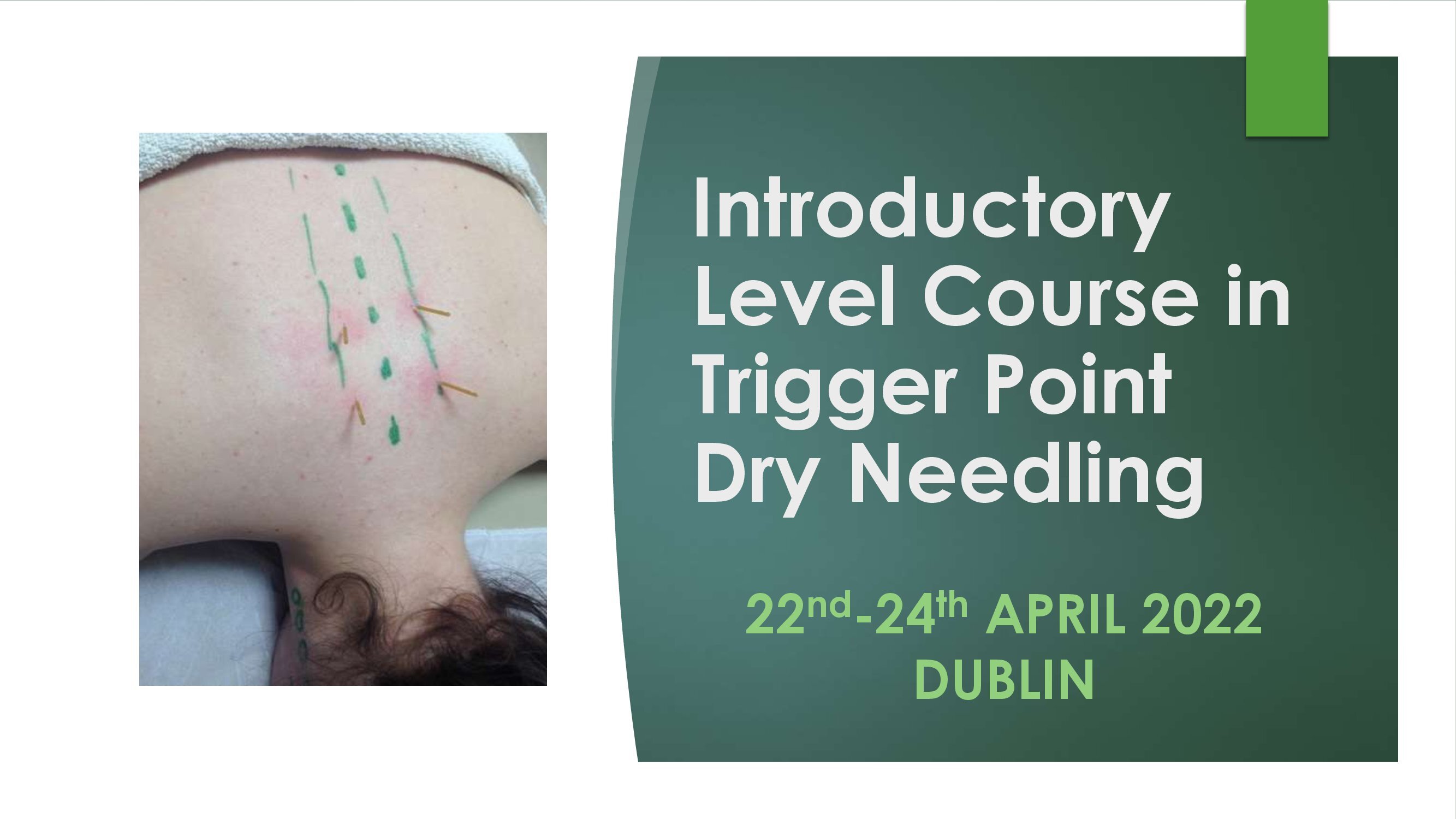 Introductory Level Trigger Point Dry Needling 22nd-24th April 2022, DUBLIN