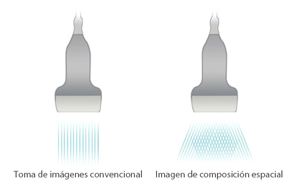 Ultrasonido Mindray DC-N3 Reacondicionado 2jpg