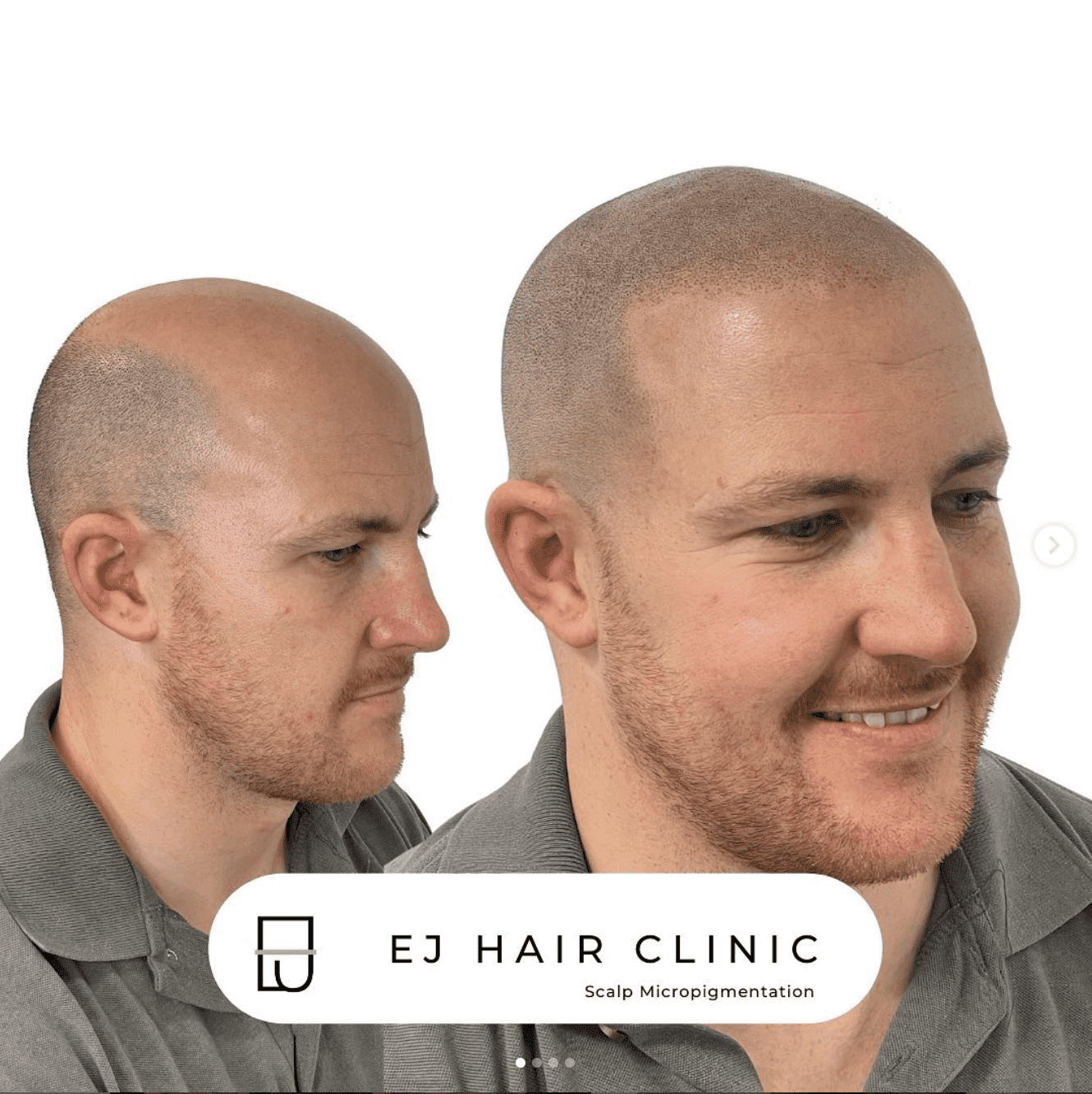 Bald man head tattoo