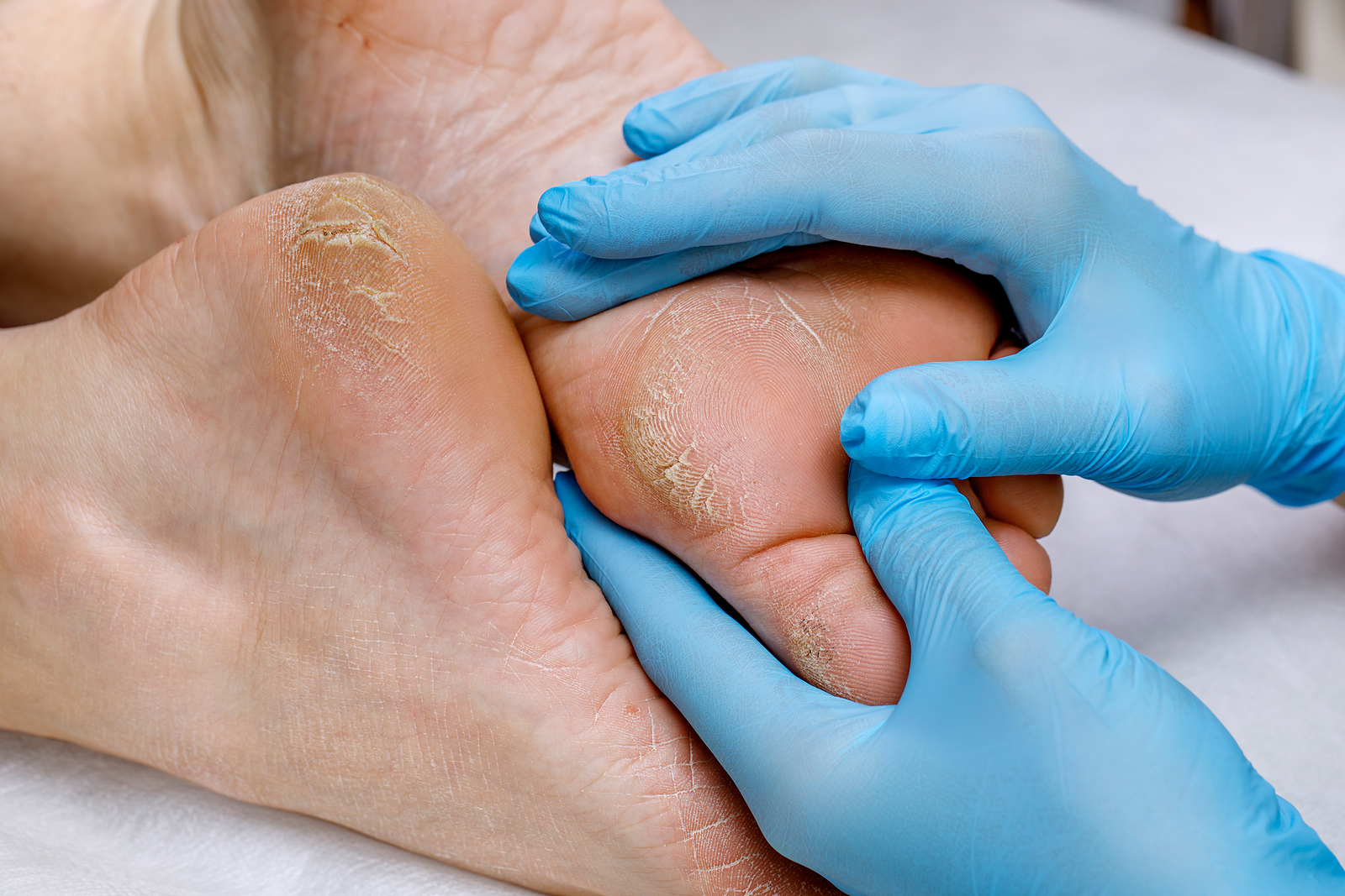 bigstock-A-Pedicure-Doctor-Examines-A-P-415909012jpg