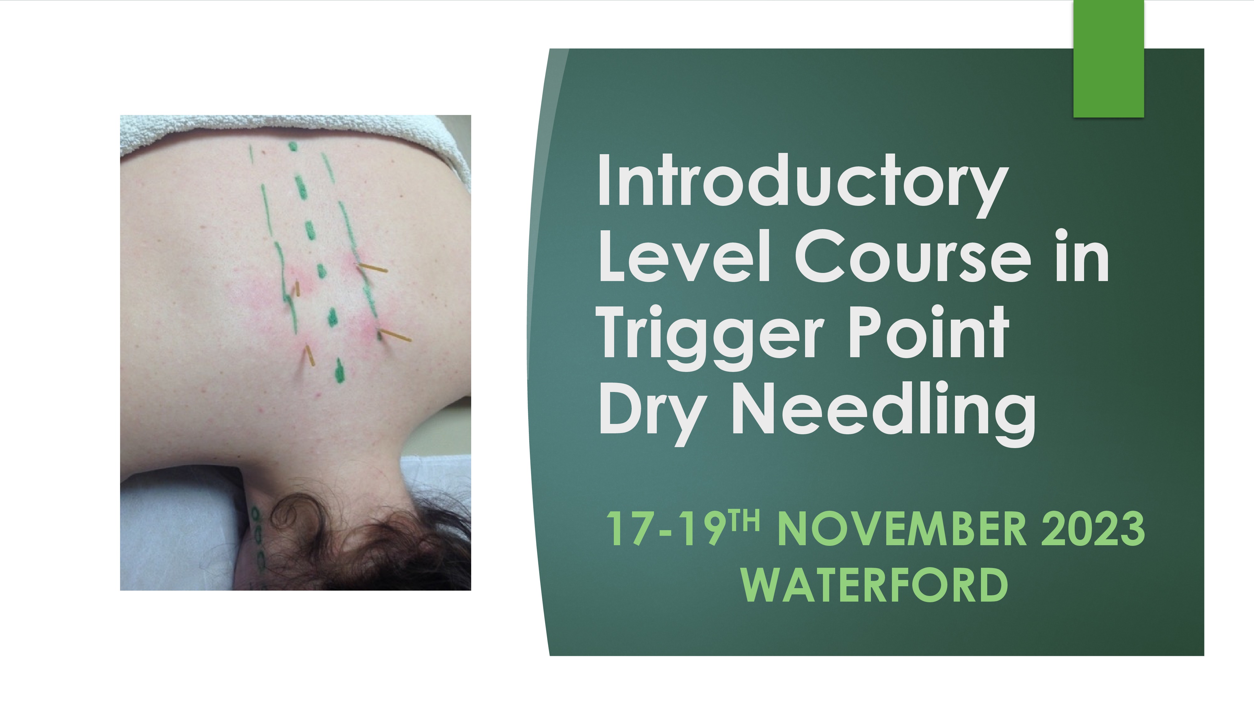 Introductory Level Trigger Point Dry Needling 17-19th November 2023, WATERFORD