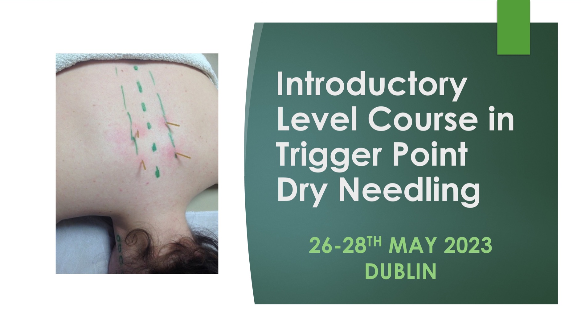 Introductory Level Trigger Point Dry Needling 26-28th May 2023, DUBLIN